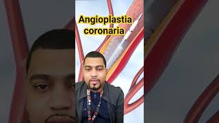 Angioplastia coronaria medicina curiosidades medicine youtubeshorts anatomia youtube doctor [upl. by Aihsenal953]