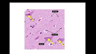 CNS 1 [upl. by Holbrook]