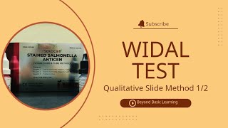 Widal Test  Qualitative Slide method  12 [upl. by Onaled436]