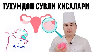 Функционал киста Фолликуляр ва Лютеин кисталари сабалари Асорати ва Даво чоралари хақида Исчанов [upl. by Eniger]