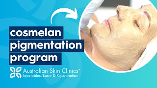 Cosmelan Pigmentation Program at Australian Skin Clinics [upl. by Placia]