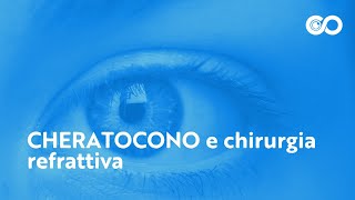 Cheratocono e chirurgia refrattiva [upl. by Rosemaria]