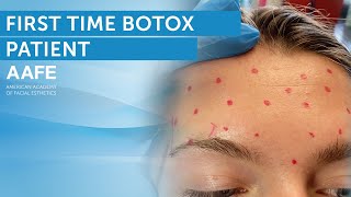 First Time Botox Treatment Plan [upl. by Nodnyl]