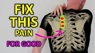 Fix Rhomboid Pain For Good Shoulder Blade Pain [upl. by Neelyak]