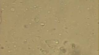 Giardia Trophozoite Looped [upl. by Kayne]