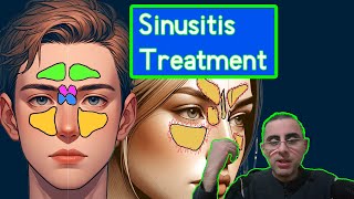 Understanding Chronic Sinusitis Symptoms Causes and Treatment [upl. by Jeconiah]