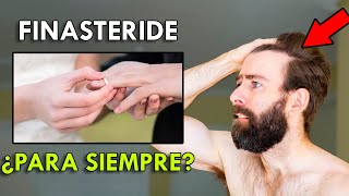 ¿Hay Que Usar Finasteride Toda La Vida [upl. by Emmott]