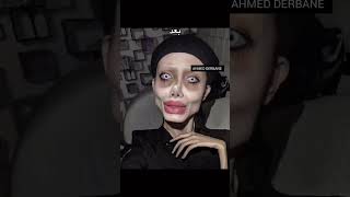 عمليات التجميل فاشلة 🫥 stitchfan funny stitchsings tiktokvideo memes bts respecttiktok come [upl. by Ellehcyt]