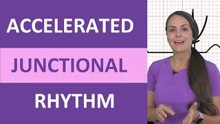 Accelerated Junctional Rhythm ECG Nursing EKG NCLEX Review Made Easy [upl. by Viviene]