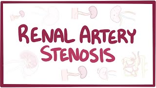 Renal artery stenosis  causes symptoms diagnosis treatment pathology [upl. by Asset480]