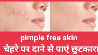 चेहरे पर दाने से पाएं छुटकारा  Pimple free face  HEALTHY LIFE  shorts skincare [upl. by Hannasus820]