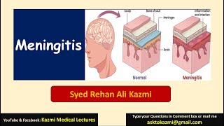 Meningitis  Neurology  Pediatric Review  KML [upl. by Malia]