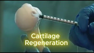 Revolutionary CARTILAGE Regeneration Tech Thats Changing Lives [upl. by Eneli]