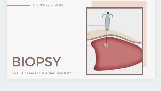 BIOPSY [upl. by Heins871]