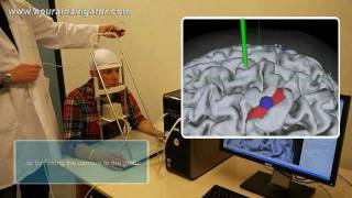 NeuralNavigatorcom demonstration [upl. by Tega]