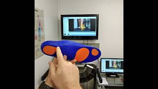 Heel Pain Treatment With Soft Orthotic Insoles [upl. by Durand958]