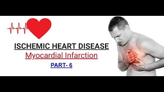 Ischemic Heart Disease  part6  Myocardial Infarction  HINDI [upl. by Dickey156]