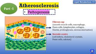 15 Atherosclerosis Part1PathogenesisMajor events Lipid Metabolism15  Biochemistry [upl. by Wales560]