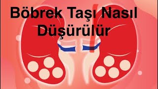 Böbrek Taşım Var Nasıl Düşürebilirim [upl. by Hankins534]