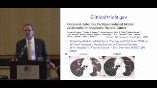 Anaplastic Thyroid Cancer Discussion Questions Answers Dr Haugen ThyCa Conference [upl. by Lois638]