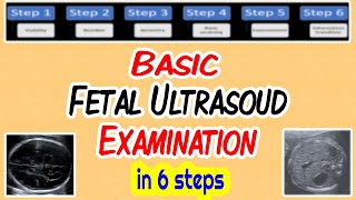 Basic Fetal Ultrasound Examination [upl. by Yahc]