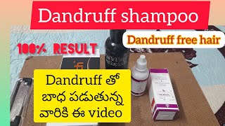 Dandruff తో బాధ పడుతున్నారా అయితే ఇదిగో ఇది use చేయండి Remedy for DandruffPersonal experience [upl. by Tai998]