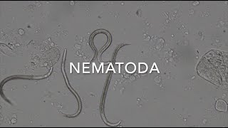 Nematodes [upl. by Auhso203]