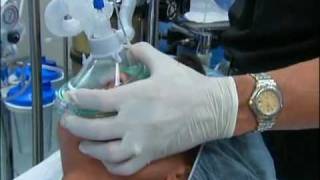 NT About Anesthesia Ch 5  General Anesthesia [upl. by Ariahs]