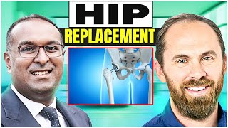 Hip Replacements  Everything you need to know [upl. by Nwahsar]