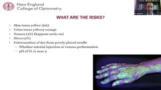 Lecture Fluorescein Angiography [upl. by Aysa]