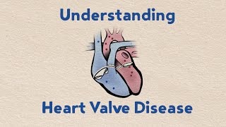 Understanding Heart Valve Disease [upl. by Ahsikahs]