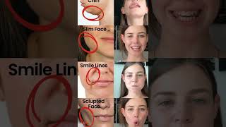 Face exercises to reduce face fat  get toned face with simple exercises shapeup [upl. by Kissner]