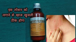 Scarab lotion  lindane and certified lotion  खाज खुलजी के दवा [upl. by Peppel]