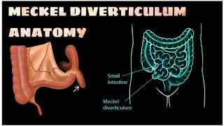 MECKEL DIVERTICULUM Anatomy brdmedicalcollege anatomy mbbs trending youtube top [upl. by Nnaeirual965]