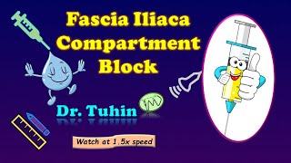 Fascia Iliaca Compartment Block  FICB  Supra Inguinal  Ultrasound  Landmark  LOR  DrTuhinM [upl. by Atiragram]