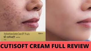 Cutisoft cream full review  Itchy Old skin peel hydrocortisone cream Pink skin remove brown spots [upl. by Mullac358]