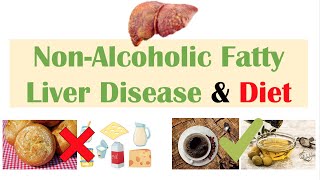 NonAlcoholic Fatty Liver Disease amp Diet  Diets to Prevent and Reduce Severity of NAFLD [upl. by Rosane]