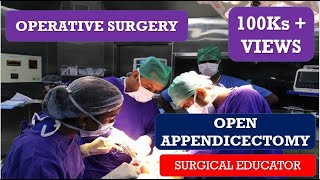 OPEN APPENDECTOMY STEP BY STEP OPERATIVE SURGERY [upl. by Aikimat444]