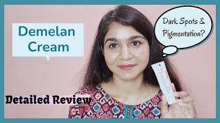 Demelan Cream Review My Experience With Demelan Cream [upl. by Ardnauqal]