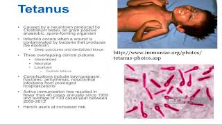 Tetanus  Epidemiology and Associated Complications [upl. by Orat124]