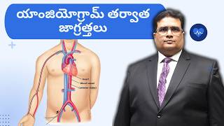 Coronary Angiogram After Care in Telugu  యాంజియోగ్రామ్ తరువాత జాగ్రత్తలు [upl. by Yemarej]