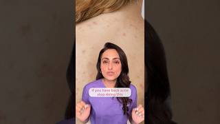 Back acne  how to treat  what to avoid [upl. by Youlton]