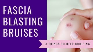 Fascia Blasting Bruises 3 Things to Help Bruising [upl. by Haidebej]