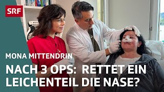 Botox BrustOP und Nasenkorrektur – Wie weit gehen wir für Schönheit  Mona mittendrin 2024  SRF [upl. by Adolpho461]