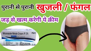 Miconazole nitrate cream ip uses in hindi  Best antifungal cream [upl. by Isaak227]