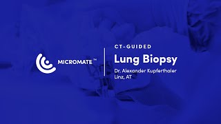 Micromate™  CTguided RoboticAssisted Lung Biopsy Dr Alexander Kupferthaler [upl. by Notyep]