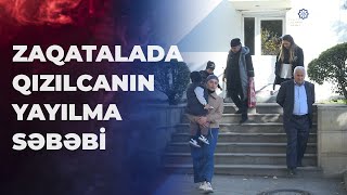 Zaqatalada qızılcaya yoluxma ilə bağlı son vəziyyət [upl. by Deenya]