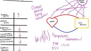 Neurogenic Shock [upl. by Nicola]