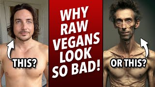 Why Raw Vegans Look So Unhealthy [upl. by Clabo556]