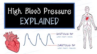 What is High Blood Pressure HealthSketch [upl. by Nahsin150]